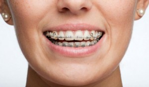 Ortodontas