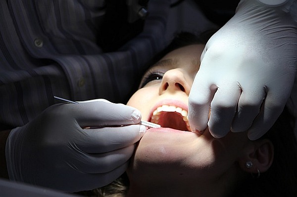 Dantų protezavimas – platus paslaugų spektras