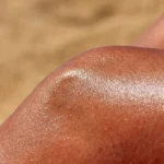 33