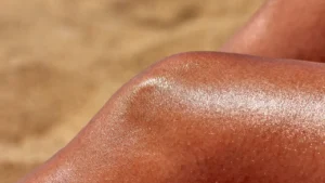 33